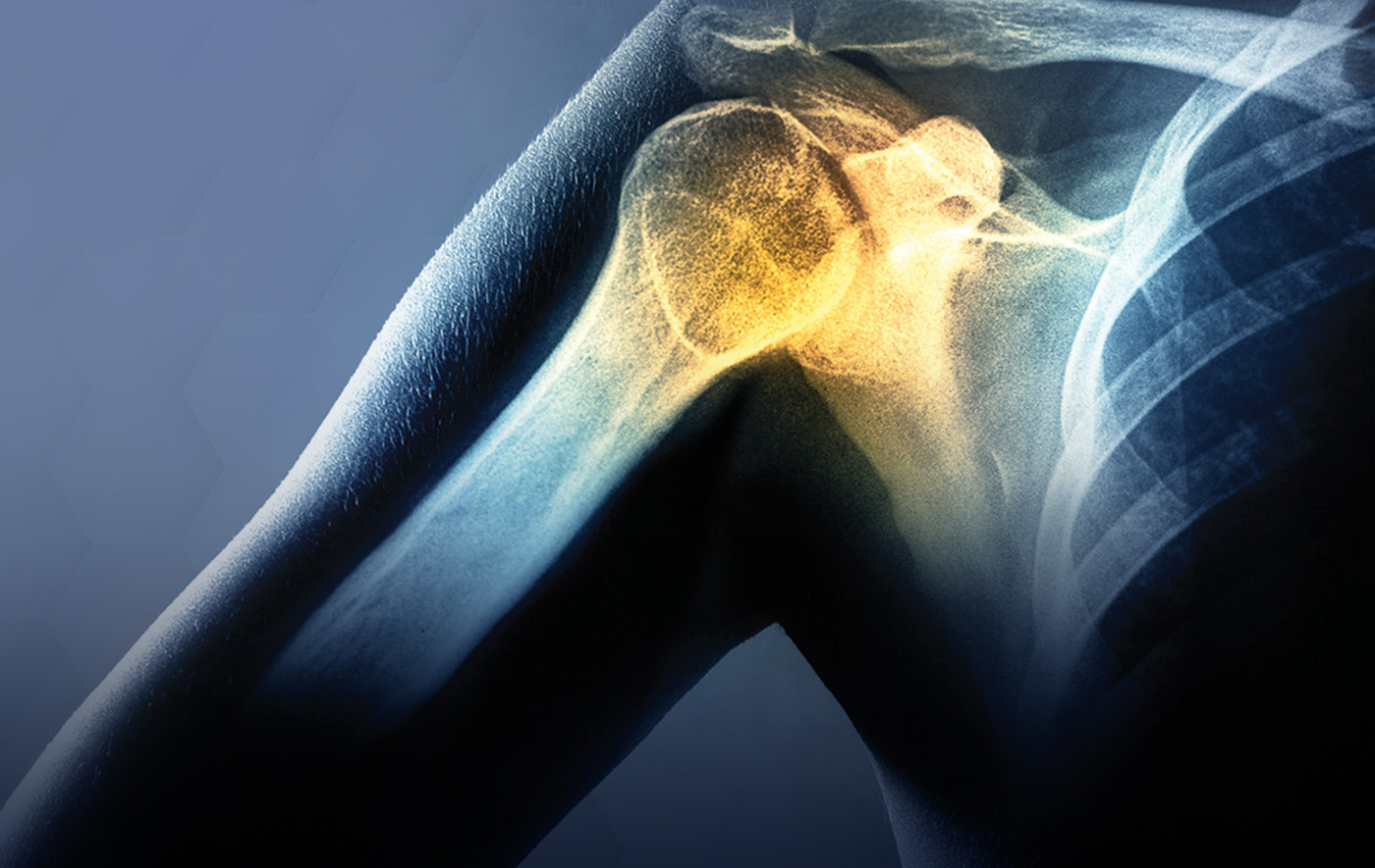 Orthopedics market